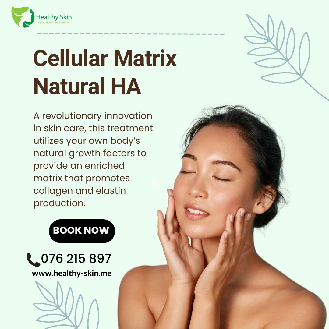 HealthySkinHKT's tweet image. Revitalize the look of your skin with✨Cellular Matrix Natural HA Enriched by your platelets&apos; growth factors.🔥Experience the breakthrough results of Cellular Matrix Natural HA today!

Learn more here 👉 buff.ly/3IfPC2j

#CellularMatrix #NaturalHA #SkinTreatment #Collagen