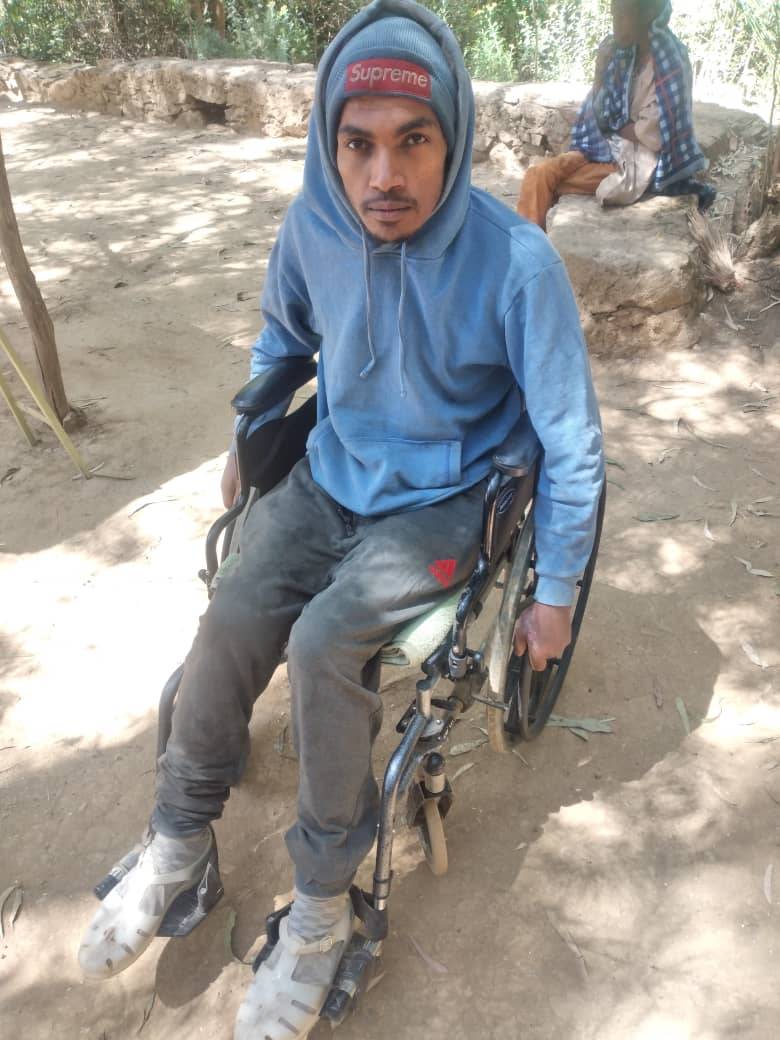 GebremeskelGeb's tweet photo. When I share this info about Henok Gebretsadik, a #TDF fighter, I am thinking of several heroes &amp; heroines who're in the same situation. I hope a well-organised movement will be launched to provide medical care for all wounded fighters. 

Photo credit: @genet_brhanu 

1/3 https://t.co/6Hev3ilf8J