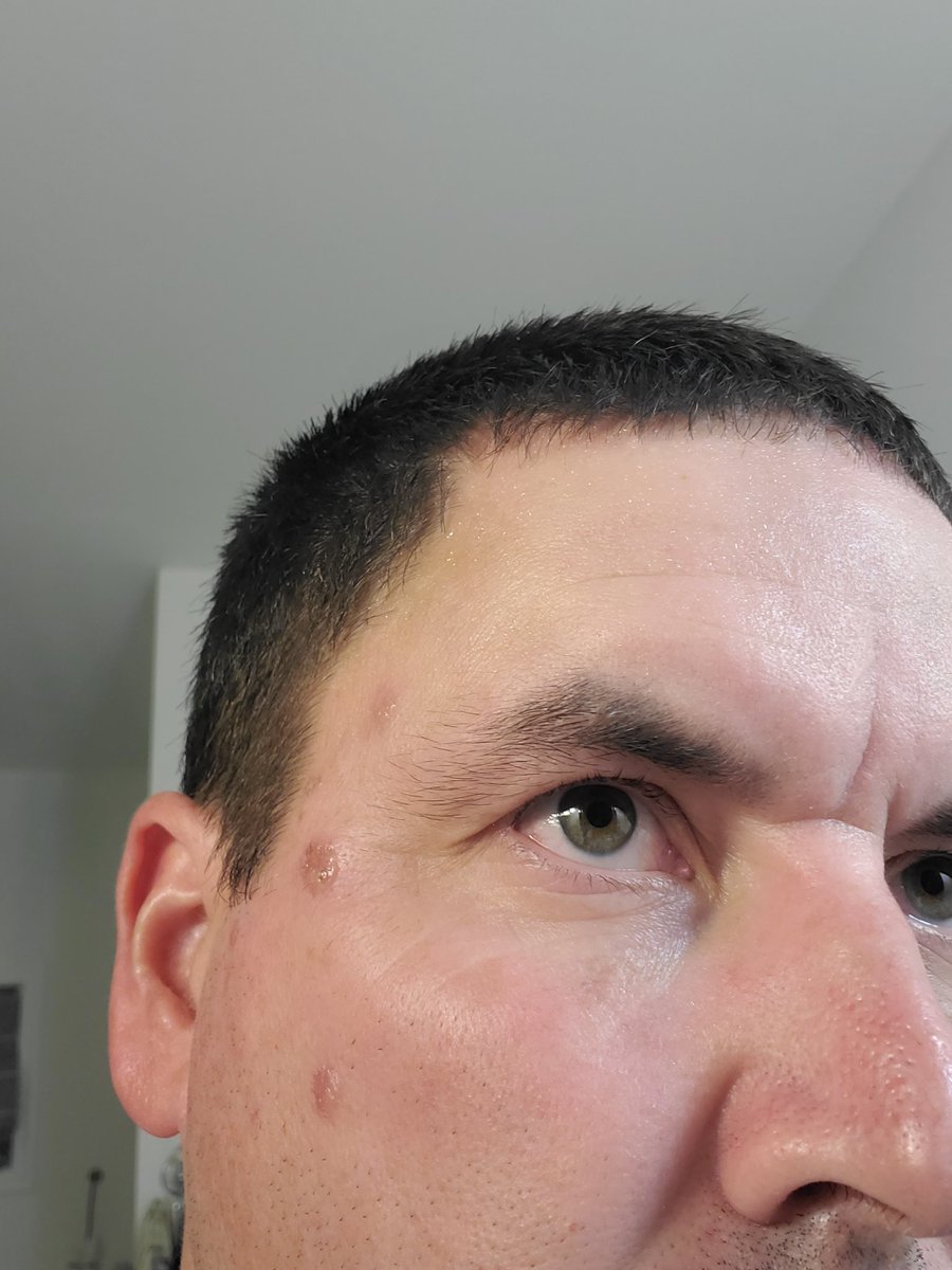 To all of the young people following all of the cool course pictures..... Don't be too busy trying to get the next task done to put on sunscreen. 41 year old you will appreciate not having doctors having to freeze off spots on your face using liquid nitrogen. Be smarter than me!