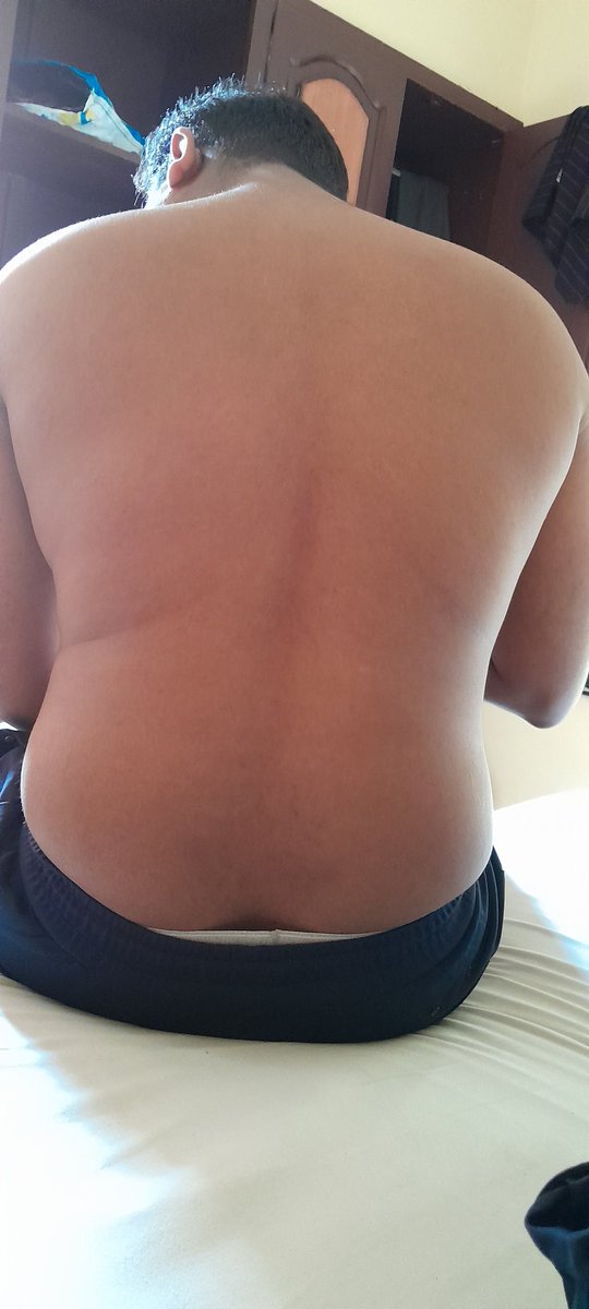 lustfor65's tweet photo. Innale njangal 2 perum koode Kalicharan sheenichu. Ravile avan ezhunettu irikkunnu. Ini veendum chappi koduttale avan happy aalulloo. Ente chekkan๐โค๏ธ
#mallumen #malluhotmen #keralahotmen #backlover #hotinshorts #keralamen https://t.co/1aDIRYAq1g