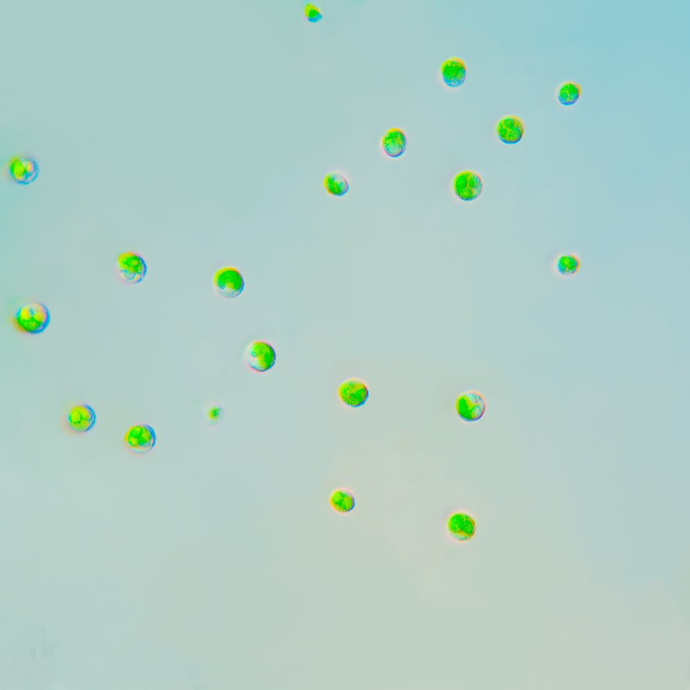 BankAlgae's tweet photo. Nannochloropsis #Phycologyfriday https://t.co/NERETp0OIq