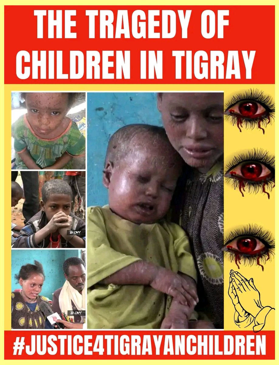 kingo4Tigray's tweet photo. 1/25
Tigrayan children have been out of school for three years, denied access to food and medicine including basic vaccines, and subjected to targeted different diseases and other forms of violence.
#ChildrenOfTigray #Justice4Tigray
@UN @antonioguterres
@UNGeneva @UNICEF https://t.co/IqSbU0dyT9