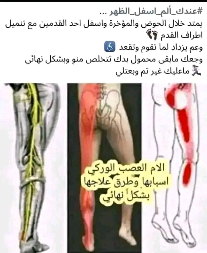 #ياهل_البزنس_وجع