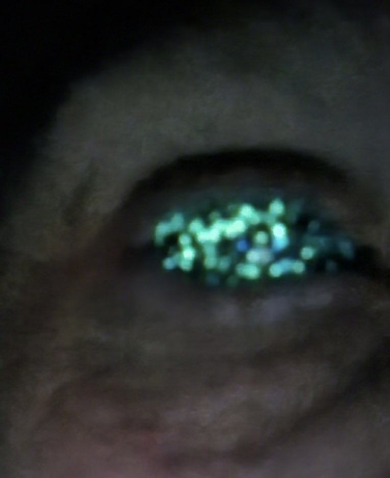 prostheticslab's tweet photo. This glow in the dark eye 🤩🤩 (galaxy with glow in the dark stars) https://t.co/WfLkVrlmgL