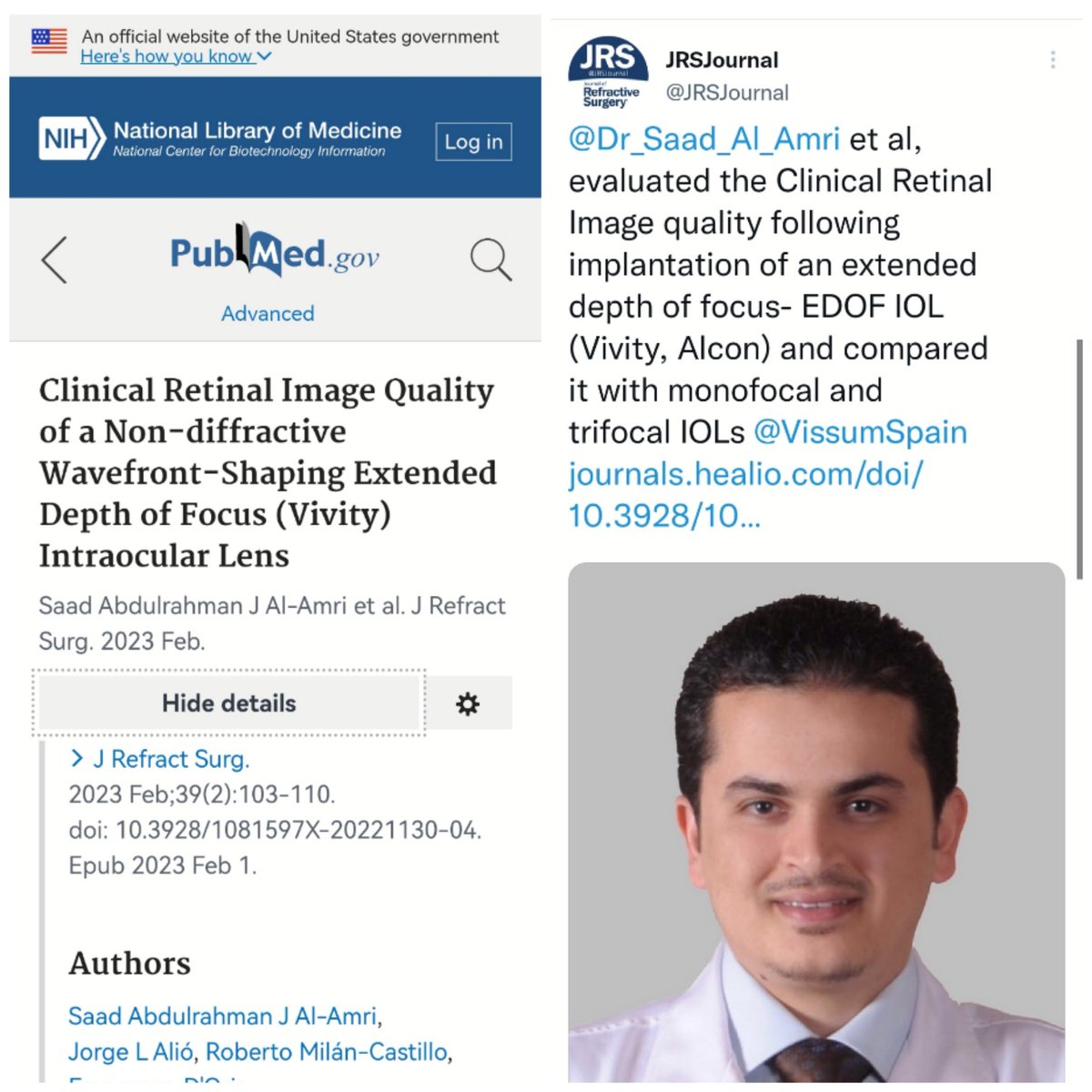 Dr_Saad_Al_Amri's tweet photo. بحمد الله، تم نشر ورقة علمية جديدة كنت فيها باحثاً ومؤلفاً رئيساً نشرت في أرقى مجلة عالمياً في ذات التخصص (مجلة جراحة تصحيح الإبصار الأمريكية) @JRSJournal وتهدف لتقييم جودة أحدث العدسات الداخلية ذات العمق الب��ري الممتد EDOF Vivity IOL بعد زراعتها جراحياً لمرضى الماء الأبيض.يتبع1⃣ https://t.co/JUpEoWN9zR