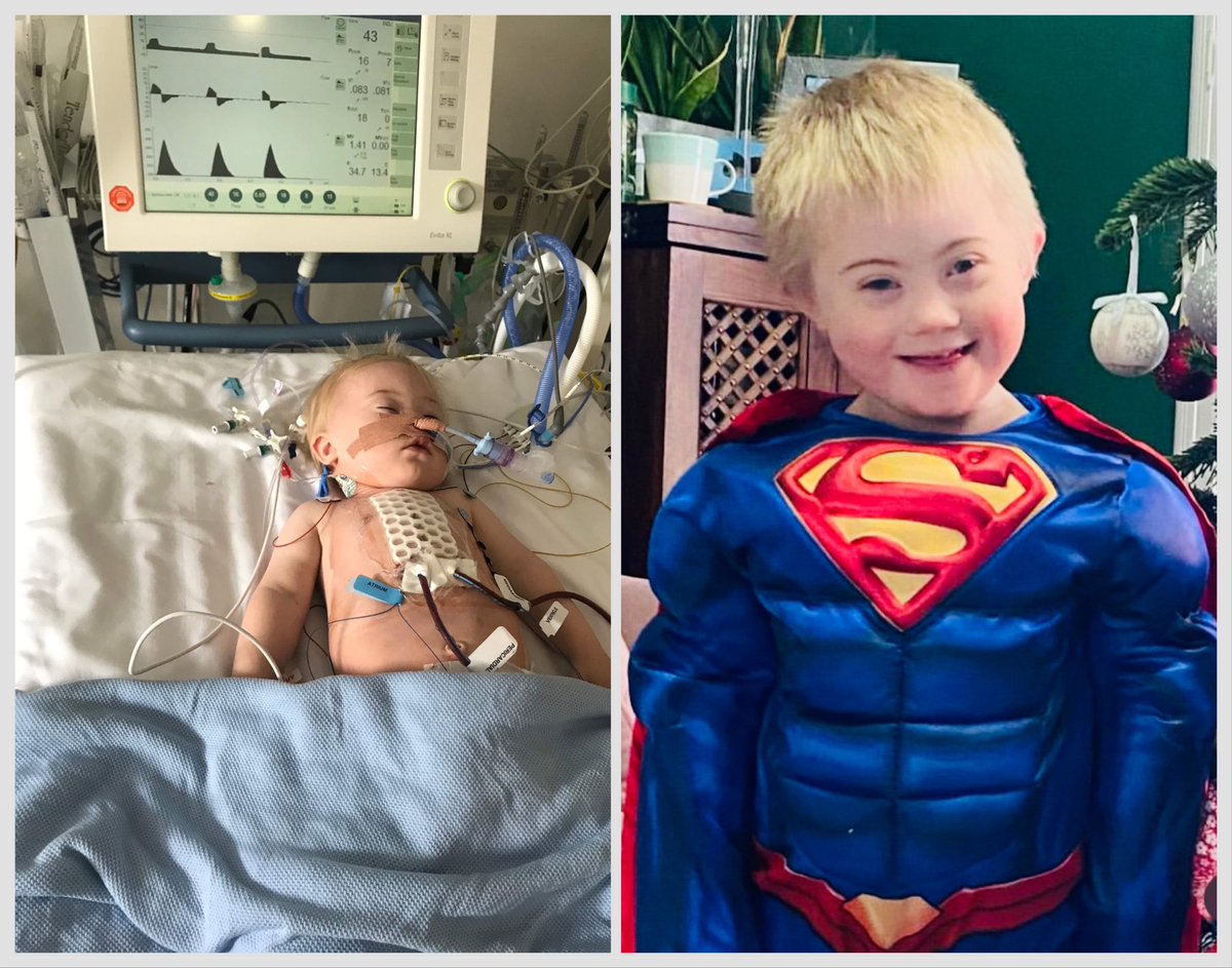 Arlo was diagnosed with a complex congenital heart condition and had life-saving heart surgery at #RoyalBromptonHospital. Thanks to their #worldclasscare he now feels like a superhero! ❤️💙 #HeartMonth #BromptonBabies #CHD #ThinkHeart #HeartHero #HeartAwarenessMonth <a href="/0RSarah/">Sarah Owen-Rafferty She/Her</a> RT