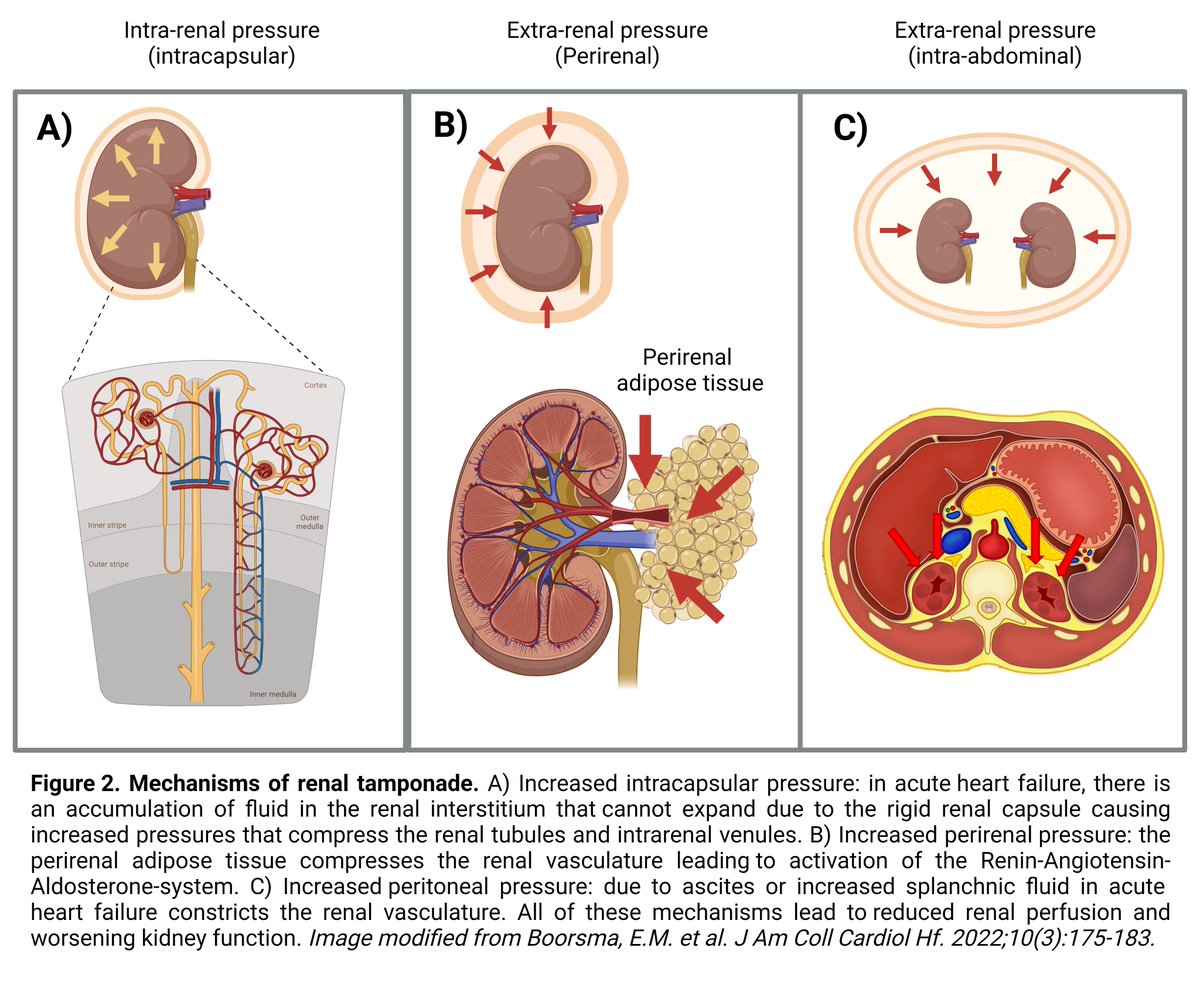 CKJ on Twitter "Kidney function changes in acute heart failure a