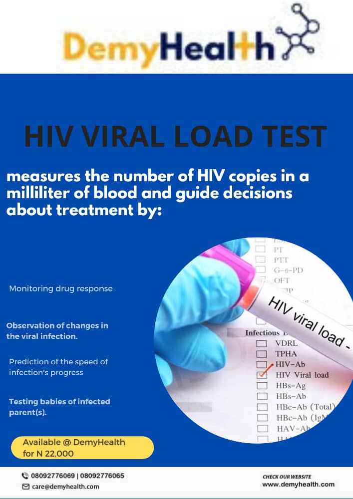 DEMYHEALTH's tweet photo. Live a healthy life despite HIV by monitoring and keeping HIV viral load at the the minimal. Visit or send your samples to @DEMYHEALTH for your HIV Viral load Test.  
.
.
.
#Health #healthyliving #hivviralload #Nationalshutdown Daddy GO Abuja https://t.co/4KCVjAtU5z