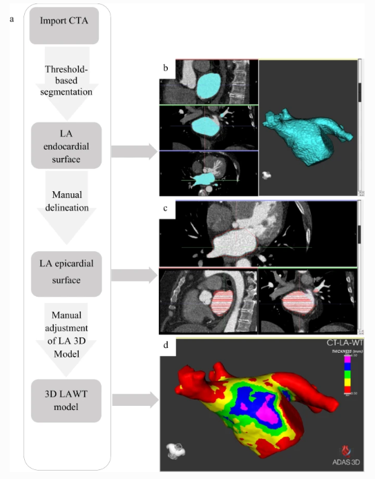 JICE_EP's tweet photo. 🚨Latest #FreeRead Article in
@JICE_EP
Reproducibility Analysis of the CT Angiography–Derived LA Wall Thickness Maps
A Valles-Colomer, BR Forcada, @Davidsotoiglesi, @DrCherylTeresEP @diegopenela1 @DrBerruezo & RM Figueras i Ventura
📖🧐: https://t.co/9So1ikK5Mw
#EPeeps https://t.co/Gw7uiB4bJz