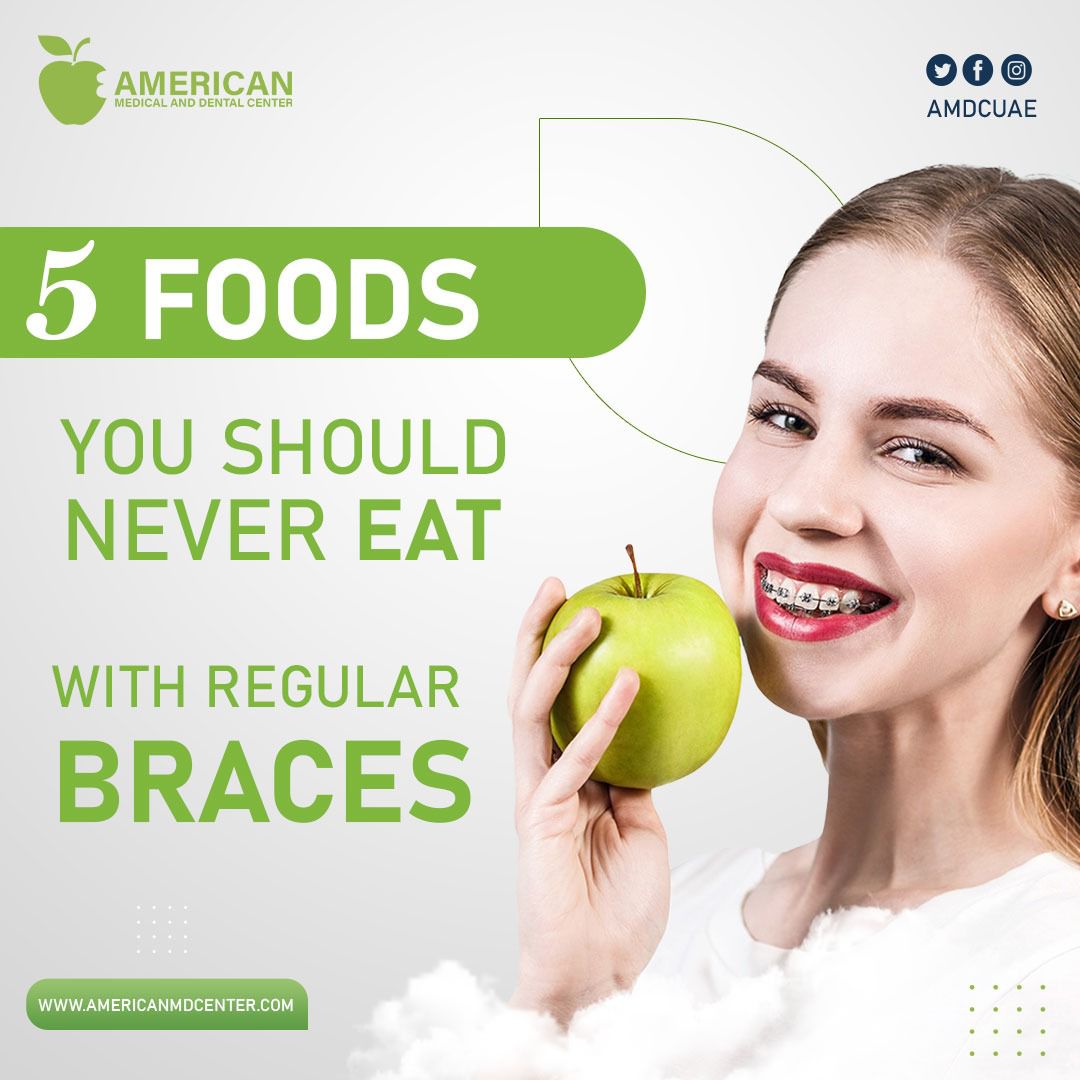 AMDCUAE's tweet photo. Now that you’ve found the foods you can eat with your braces, it’s time to make a list of the foods you should never eat with them.

Let`s keep your smile as healthy and strong as possible.😁

#DentalRootTreatment #DentalRestorations #DentalImolants #DentalClinics #ToothImolant https://t.co/GaaQwhM1Mv