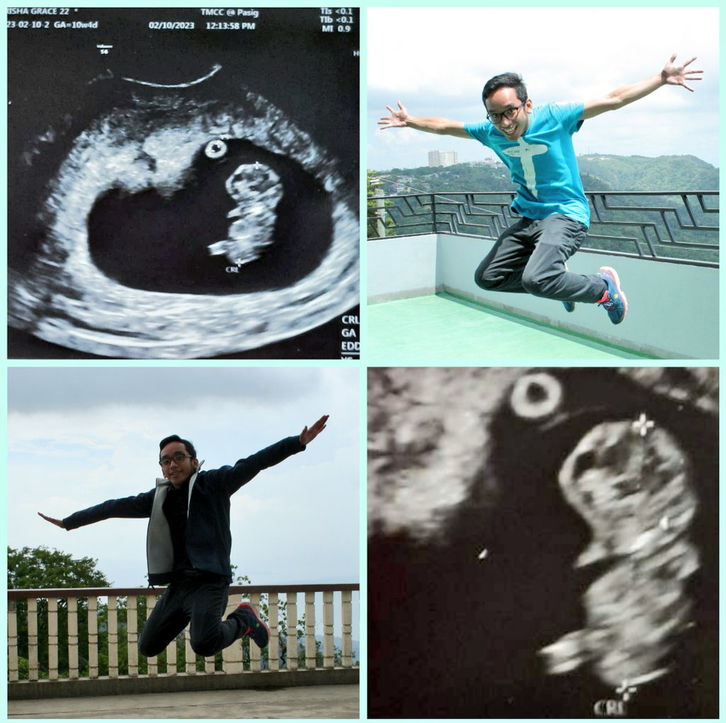 trshflrstdd's tweet photo. Gaano ka ka-active baby?
Nakakaupo, nakakatayo at nagkukuyakoy ka pa talaga na dapat nakahiga lang position mo at your week old. Magkasing-hyper siguro kayo ni tatay @Slash_Troy kaya gusto ka raw nyang makita every month through ultrasound https://t.co/T9N5qJBus6