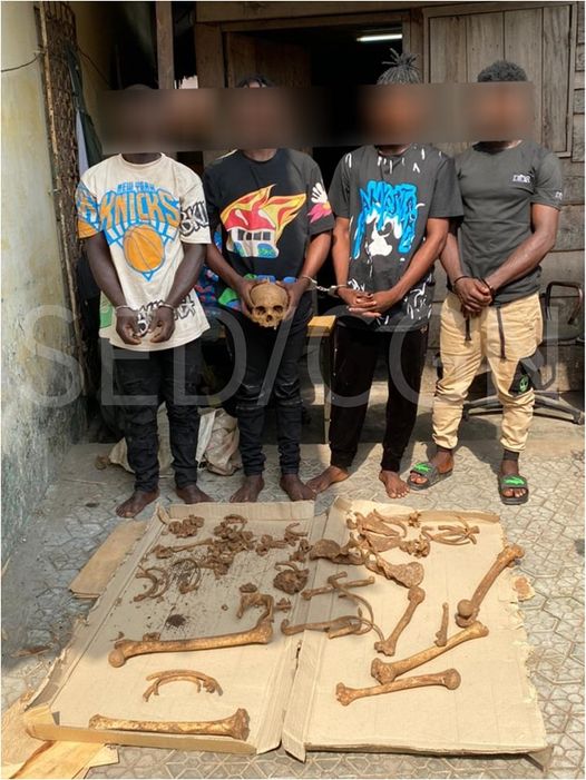 TheCameroonianZ's tweet photo. Interpellation de 4 individus âgés entre 16 et 30 ans, pris en possession d’une cargaison d’ossements humains au lieu-dit Ancienne route Boulangerie Lycée Bonabéri, à Douala. https://t.co/BQr0DSWkRK