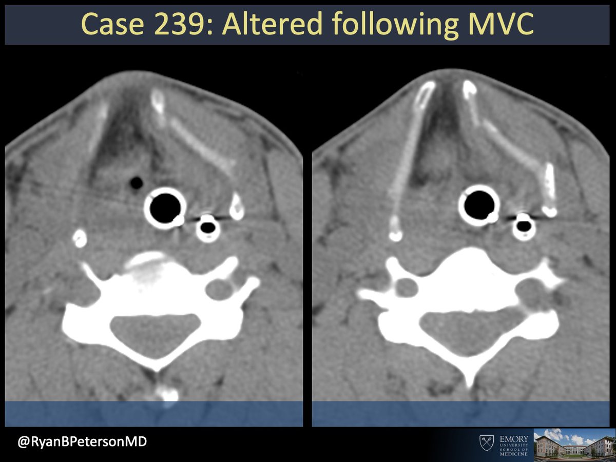 Ryan B Peterson 🇸🇪 tweet media