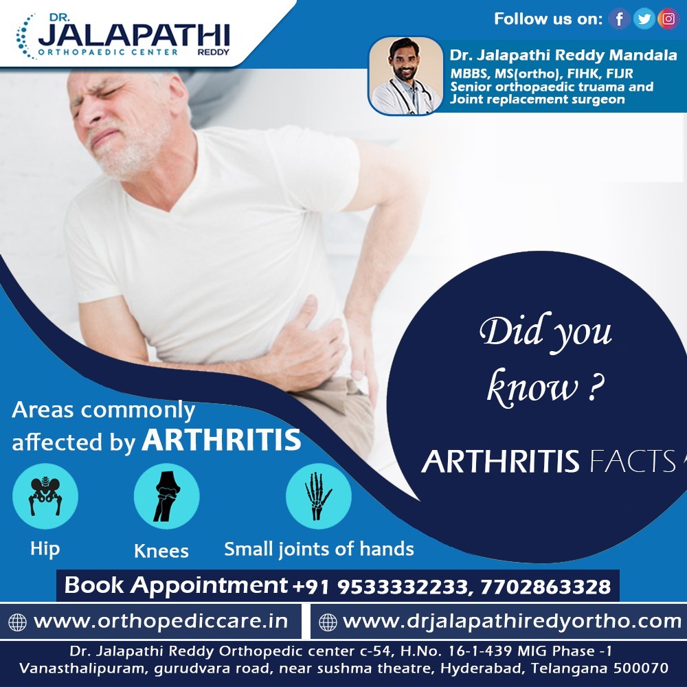 Early #arthritis tends to affect your #smallerjoints first particularly the joints that attach your #fingers to your #hands and your toes to your #feet.
#DrJalapathiReddy #OrthopedicCentre #Orthopaedicdoctor #OrthopaedicSurgeon  #OrthopaedicSpecialist #orthopaedics #rheumatology
