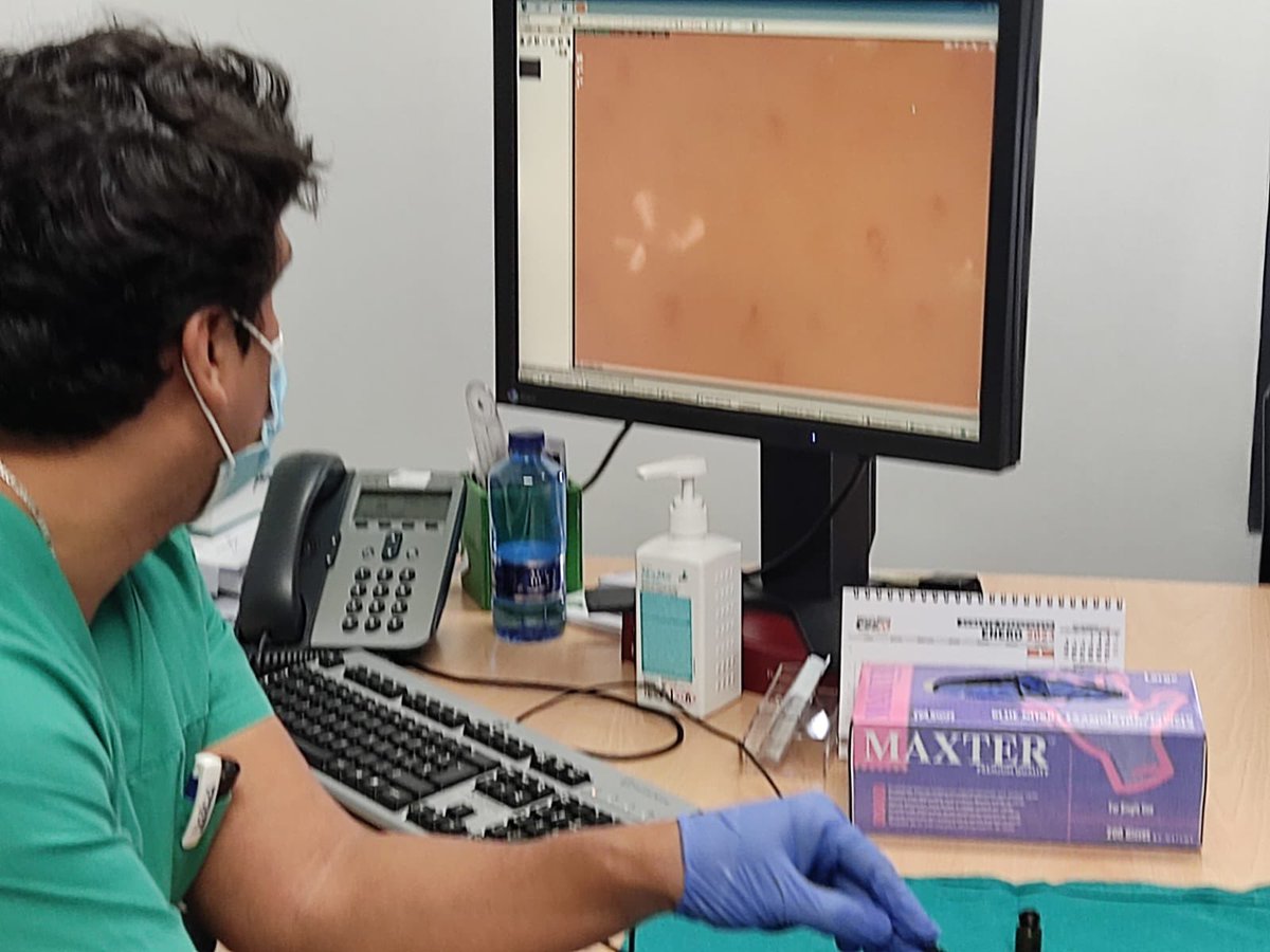 Reuma_HGUCR's tweet photo. Hoy en laboratorio de Reumatología hemos realizado técnicas guiadas en el raquis como bloqueos de sacroiliacas, facetarios, epidurales lumbares, musculares… y además capilaroscopias. Con ello se consigue la mejora del paciente más rápida y evitando listas de espera innecesarias https://t.co/oM7sSmpqqW