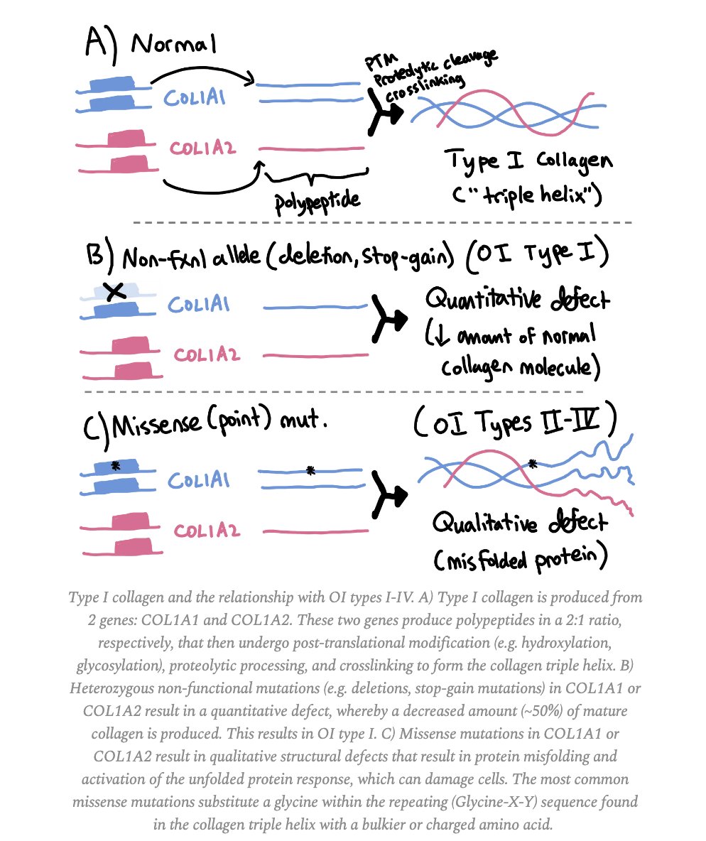 studyrare's tweet photo. @OGdukeneurosurg For a case discussion of the pathogenesis of osteogenesis imperfecta, check out one of my posts from last month: https://t.co/AacLVXx7sL https://t.co/pYtGGRvoCl