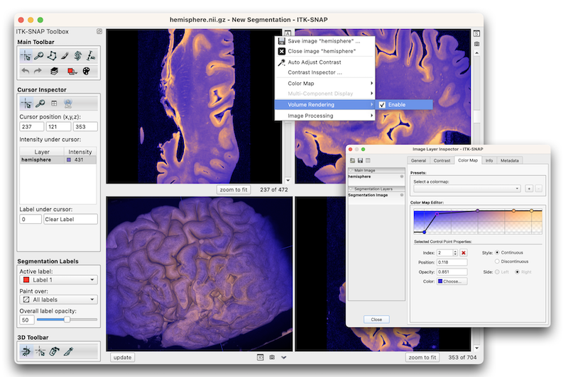 Just released: ITK-SNAP 4.0.0, with support for 3D+time imaging data, volume rendering, mesh layers, better inter-slice interpolation, and more. New features: itksnap.org/pmwiki/pmwiki.…, download page: itksnap.org/pmwiki/pmwiki.….