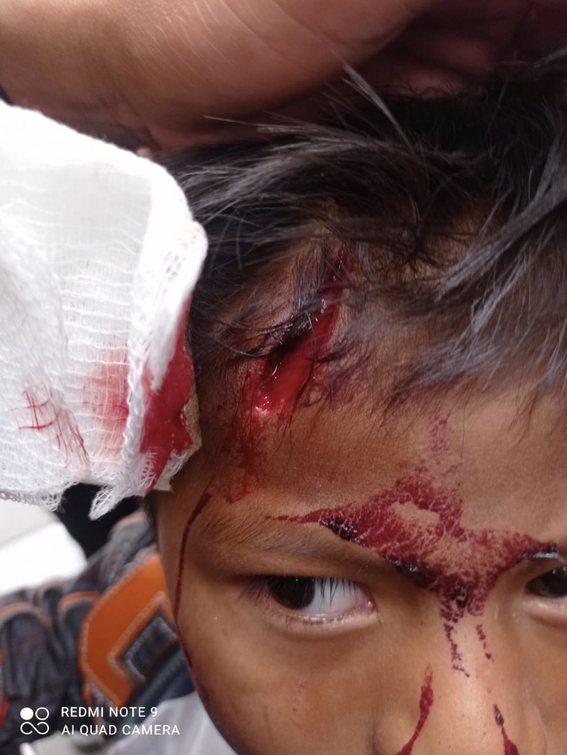 HOLLMANMORRIS's tweet photo. Alcaldesa @ClaudiaLopez ¡aclaren esto! 

Ciudadanía informa que en la calle 19 fueron golpeados por policías niños emberas, esto es inadmisible.

Ya es demasiado que a esta alcaldía le quede grande proteger la vida de los más vulnerables y ahora golpeen a sus niños. https://t.co/1mVKa9NC2P