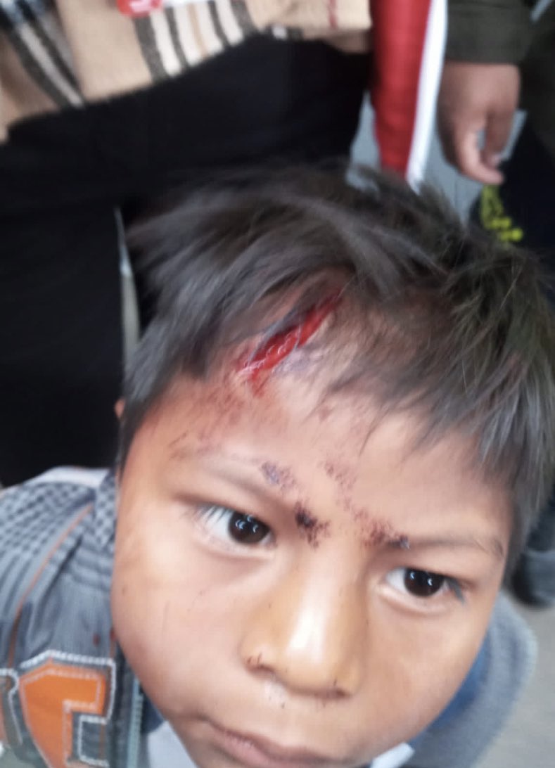 HOLLMANMORRIS's tweet photo. Alcaldesa @ClaudiaLopez ¡aclaren esto! 

Ciudadanía informa que en la calle 19 fueron golpeados por policías niños emberas, esto es inadmisible.

Ya es demasiado que a esta alcaldía le quede grande proteger la vida de los más vulnerables y ahora golpeen a sus niños. https://t.co/1mVKa9NC2P