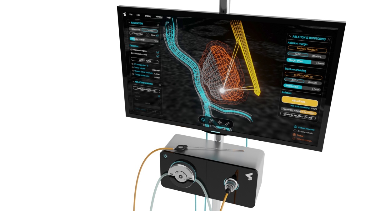 mszerencsy's tweet image. Current Surgical is developing a ‘smart’ needle designed to treat cancerous tumors dlvr.it/SjmLTJ #BiotechHealth #Hardware #RoboticsAI