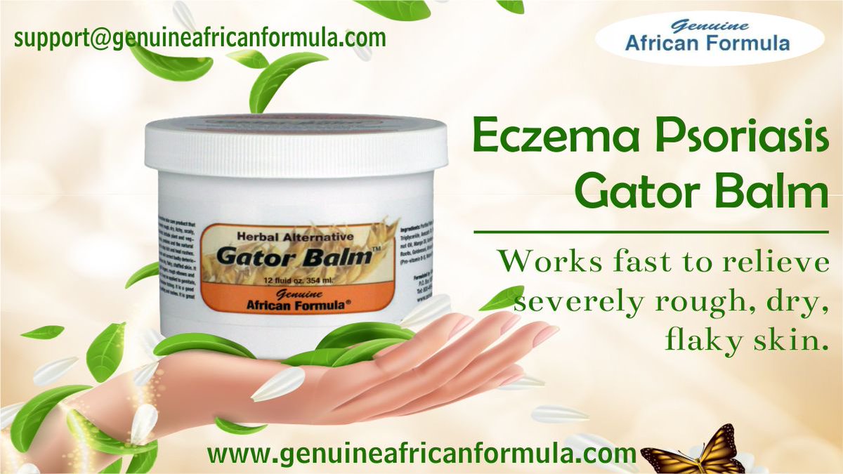 AfricanFormula's tweet image. Buy online Eczema Psoriasis Gator Balm from Genuine African Formula.Shop here- bit.ly/3KqU1lA or Call us at 1-800-495-0459 to order now
#GenuineAfricanFormula #EczemaPsoriasisGatorBalm  #Natural #Beauty #HerbalProducts #OrganicProducts #Bodycareproducts