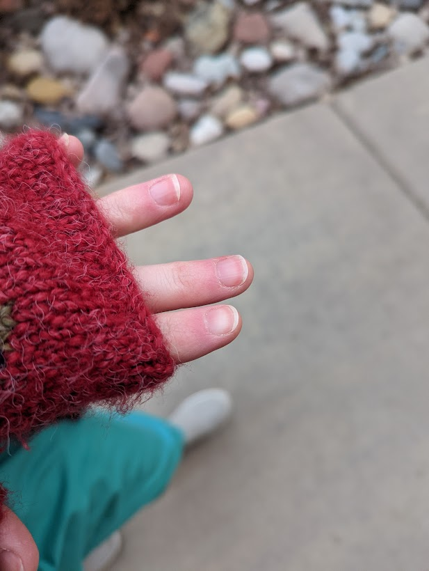 One of the most amazing/surprising things about getting my #ADHD treated is now I can finally grow out my nails! I used to pick (not bite) my nails constantly. It's been amazing to notice my nails growing out over the last year!  Pre and post seen below
