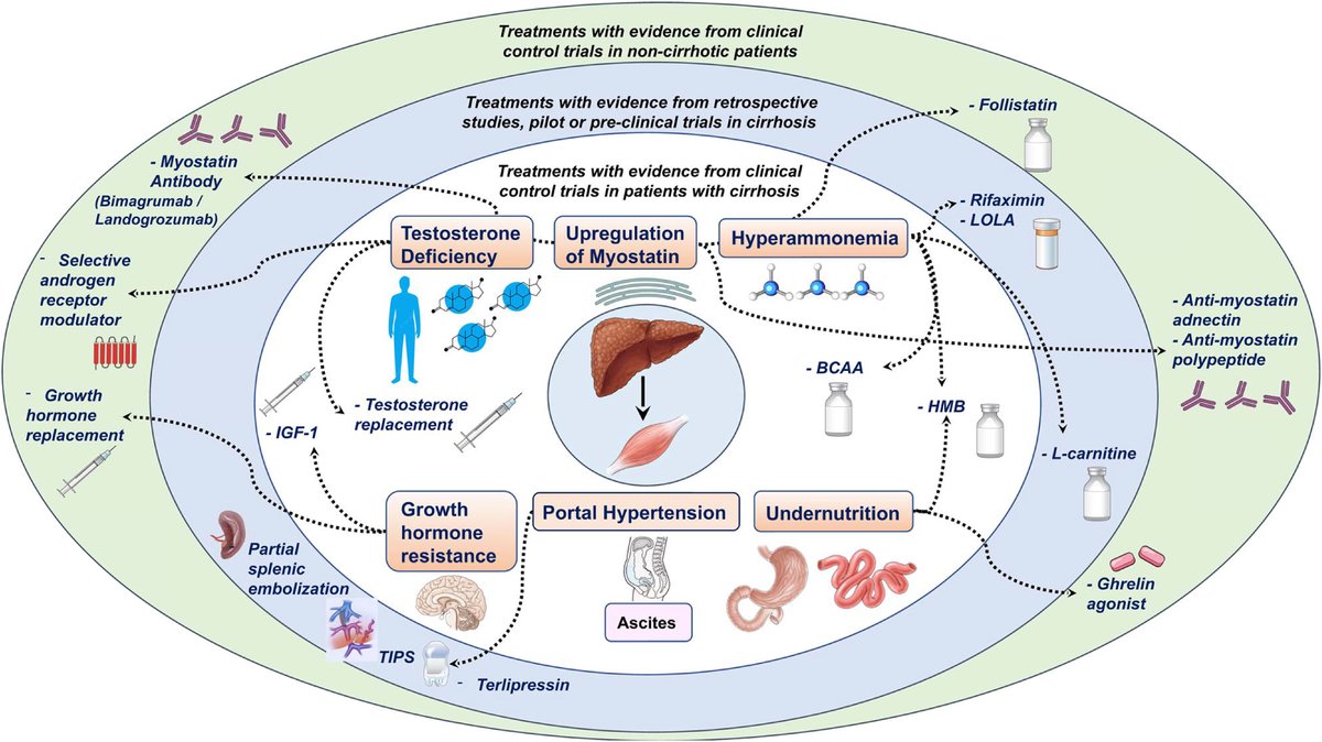 What are the mechanisms of SARCOPENIA in cirrhosis and how can we treat it ?

We need novel therapies besides diet and PT. This great review in <a href="/JHepatology/">Journal of Hepatology</a> describes the mechanisms y novel therapeutic options.

bit.ly/3ShtbhV #livertwitter #medtwitter <a href="/aldomontanoloza/">Aldo J. Montano-Loza</a>