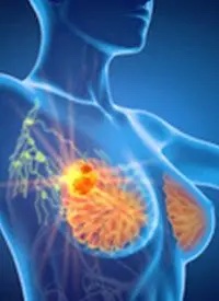 Great advancement in breast cancer.
#breastcancer #breastcancercare #breasthealth #MammaPrint #BluePrint
ow.ly/p3vV50MXlOg