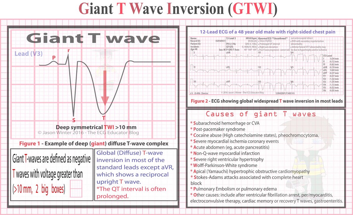 Mahmudul Hasan on Twitter: