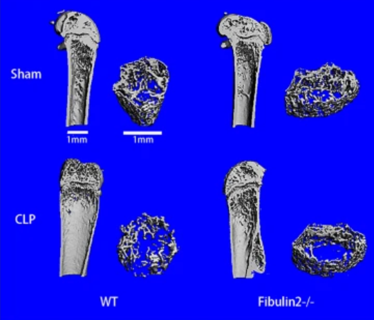 MesenchymalCell's tweet photo. A team of scientists 👨‍🔬👩‍🔬 demonstrated that Fibulin2 is a negative regulator of bone marrow mesenchymal stem cell (BMSC) osteogenic differentiation that inhibits ❌#osteogenesis by inactivating the #Notch2 signaling pathway in infected bone 🦴.

📌 https://t.co/l9yYuXn8fQ https://t.co/xph80zXxkH