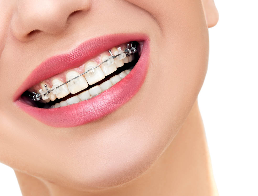 WilliamJCollie2's tweet image. We offer timeless experience of successful work and our professionals are always friendly and provide the utmost in honest customer service. Visit us to learn more about our services at 2209 Jordan Ave! #TeethImplants #FamilyDentist #RootCanals bit.ly/3KptSjB