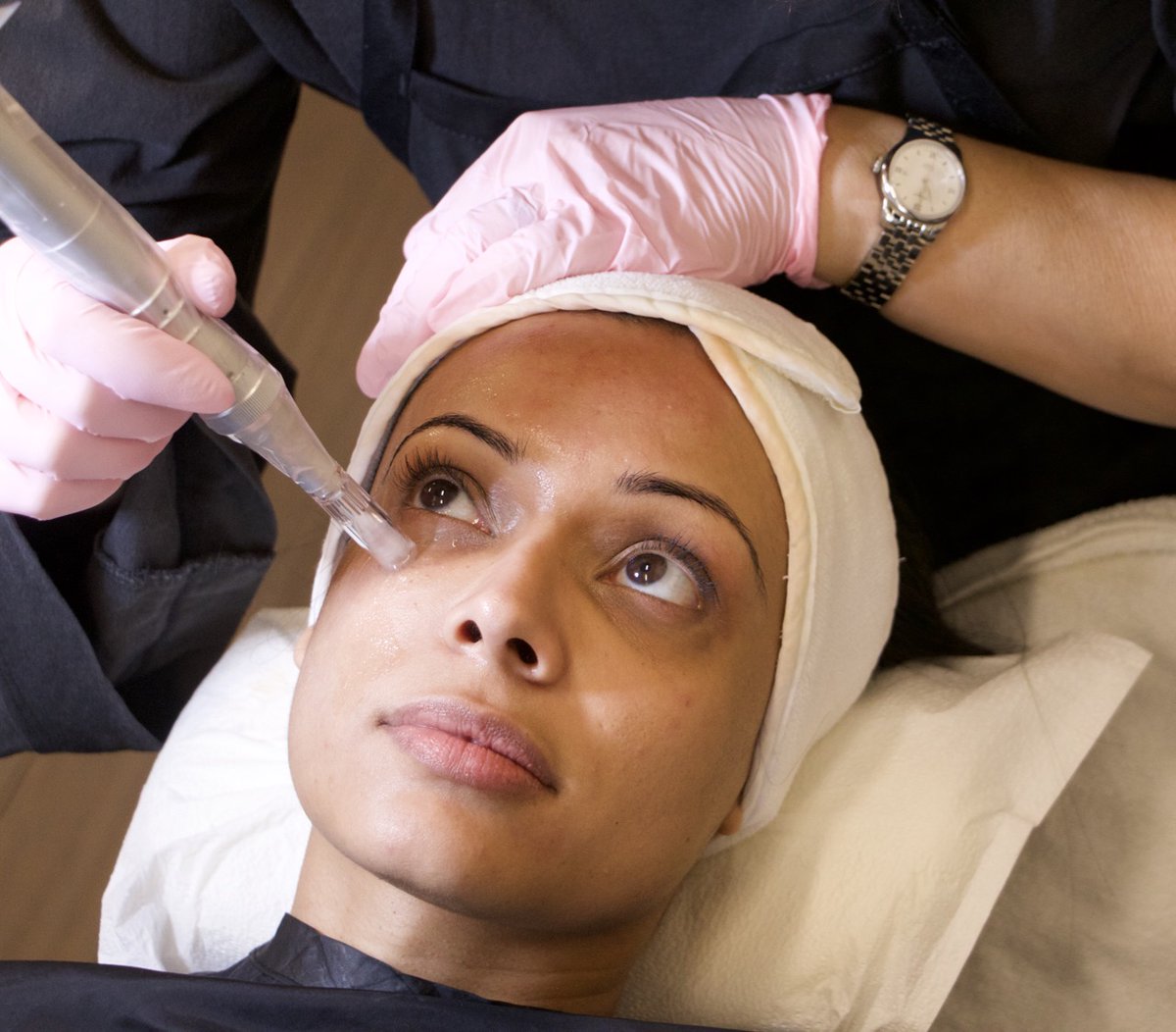 blitzfacialbar's tweet photo. As part of your micro-needling treatment, your Medical Aesthetician will also treat around your eyes to promote collagen production, help reduce fine lines, and treat dark circles and puffiness. 

Book a Complimentary Consultation to learn about the benefits of Micro-Needling. https://t.co/GASF2HWIlY