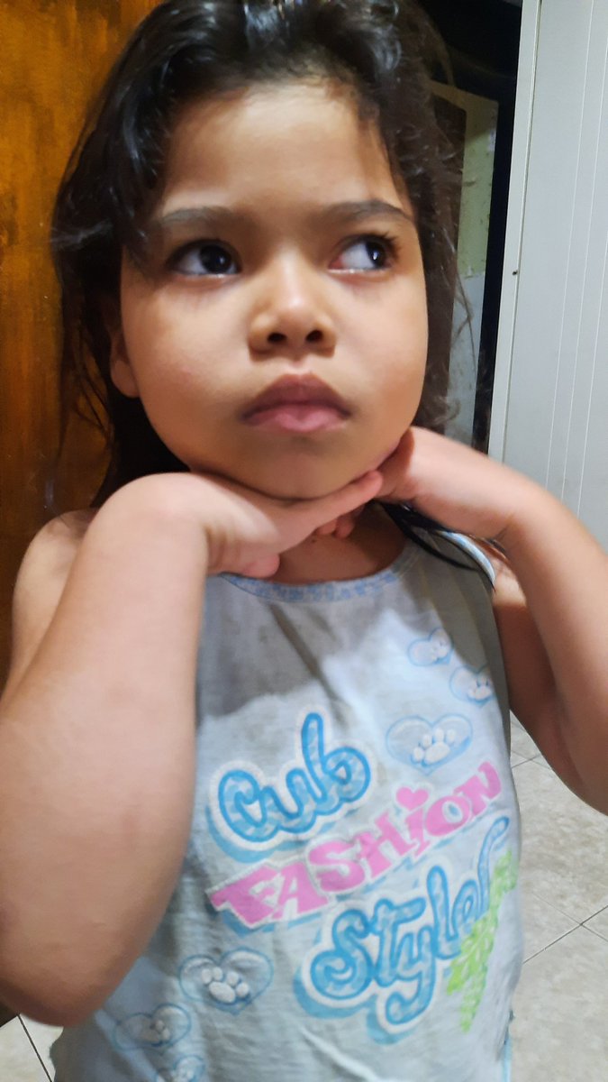 mariani87784922's tweet photo. Soy Mariana mi diagnostico :
🔹️Hidrocefalia tabicada
🔹️Hemiparesia izquierda
🔹️Pubertad precoz
🔹️Alto riezgo biologico de hemorragia cerebral.
🔹️Epilepsia estructural
🔹️Astigmatimos miopico
🔹️Hernia inguinal izquierda 
Quisiera llevar una vida normal 👇 https://t.co/ZT9TBNWlgY
