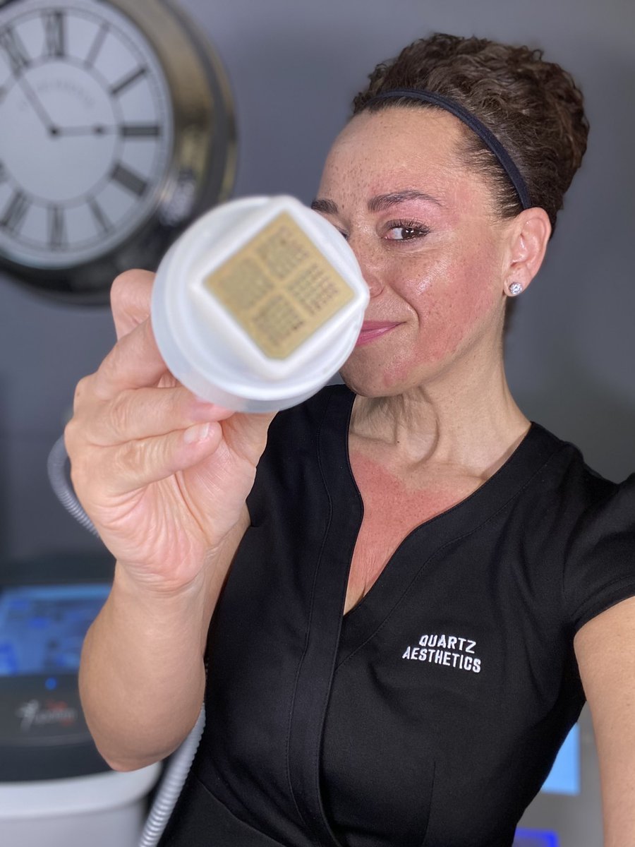 QuartzBanbury's tweet photo. Don’t mess with a female in the middle of her skin glow up!! The Gen100 skin remodelling collagen induction. ‘Reset’ ‘Refresh’ and ‘Rejuvenate’ your skin. Non surgical #microneedling #collageninduction #antiageing #acnescars #pigmentation #younger https://t.co/2WdpcLWSDJ