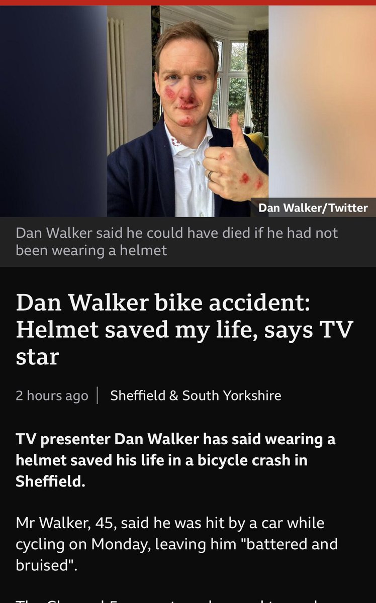 Bike helmet saves life is the headline.   Why isn’t it CAR DRIVER ATTEMPTED TO KILL DAN WAKER?