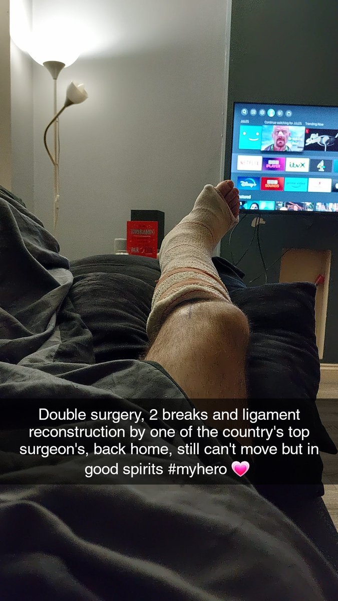 julest33's tweet photo. @SPanthersFC1 what a fuckin mess both physically and financially for at least 4 months it has made to our family life, hopefully ur having words with Charles Lunt about the severity of his takle and the absolute twat on ur team who delayed me to get on the pitch!!! https://t.co/1TBZkWqxyd