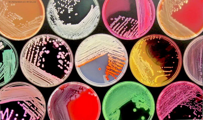 Colourful Petri dishes with bacterial colonies growing