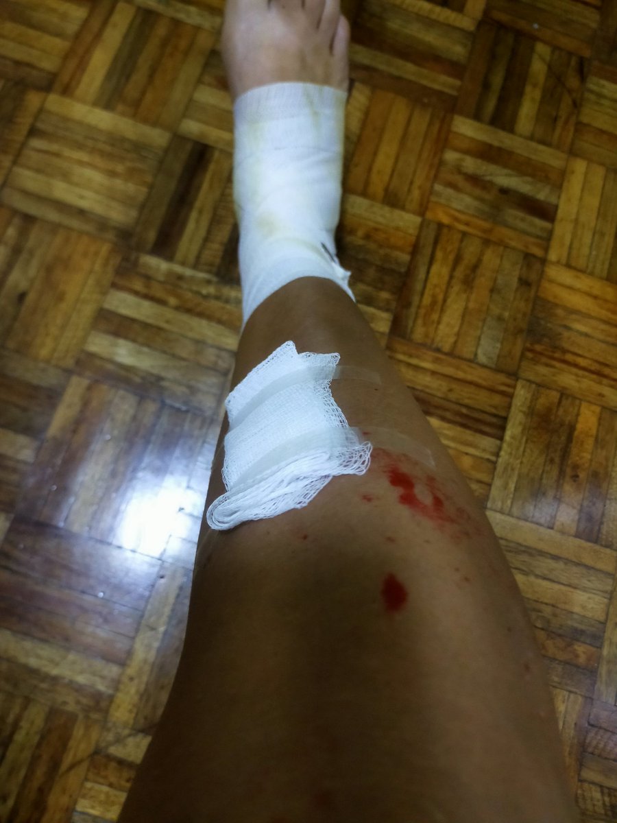 samano_O's tweet photo. Mi cuerpo aún está lleno de polvo químico que lanzaron a mi cara y los golpes que me dieron elementos de seguridad del @Congreso_CdMex, hoy no solo me duele el cuerpo sino el alma de no estar segura.
No me voy a callar @Claudiashein @martibatres su ciudad no es de derechos. https://t.co/dSl7KnQxSk