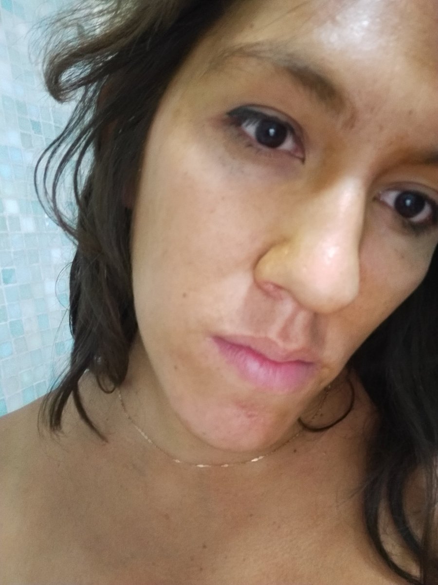 samano_O's tweet photo. Mi cuerpo aún está lleno de polvo químico que lanzaron a mi cara y los golpes que me dieron elementos de seguridad del @Congreso_CdMex, hoy no solo me duele el cuerpo sino el alma de no estar segura.
No me voy a callar @Claudiashein @martibatres su ciudad no es de derechos. https://t.co/dSl7KnQxSk