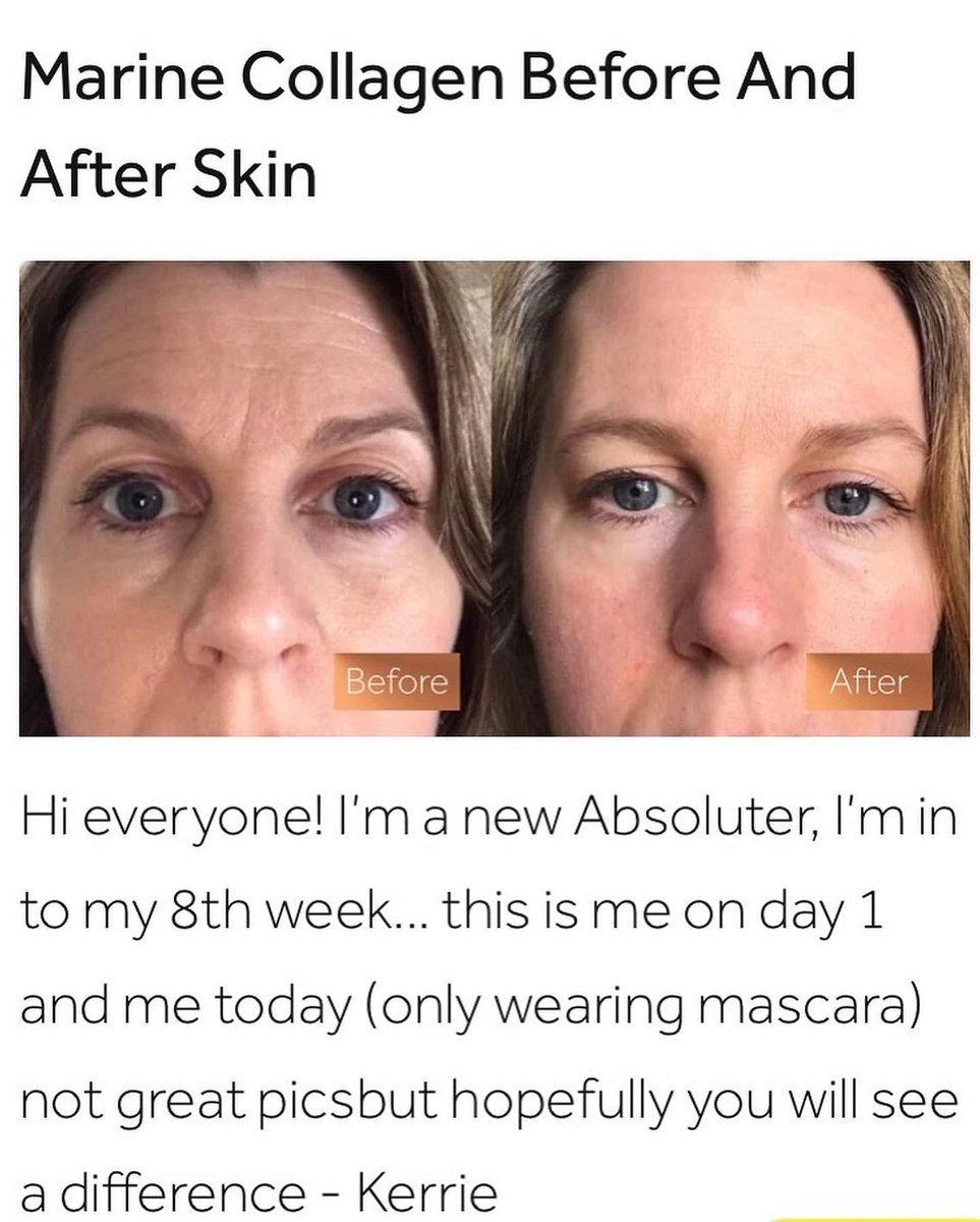 MattCoup1980's tweet photo. Our Collagen capsules. Natural anti aging. #collagen #skincare #beauty #antiaging #skin #vitaminc #glutathione #glowingskin #pemutihkulit #whitening #skincareroutine #healthyskin #serum #health #collagenpowder #vitamin #acne #gluta #glowing #glutax #pemutih #fitness #facial https://t.co/gxyPXwIBb3