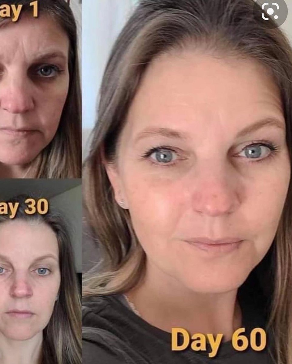 MattCoup1980's tweet photo. Our Collagen capsules. Natural anti aging. #collagen #skincare #beauty #antiaging #skin #vitaminc #glutathione #glowingskin #pemutihkulit #whitening #skincareroutine #healthyskin #serum #health #collagenpowder #vitamin #acne #gluta #glowing #glutax #pemutih #fitness #facial https://t.co/gxyPXwIBb3