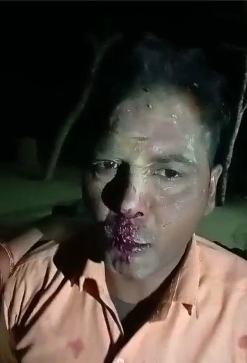 Anoopkumarpasi's tweet photo. थाना मान्धाता के अतर्गत ग्राम उडीकाडीह दिनांक 15/2/ 23 शाम 6 की घटना है  नीतूदेवी पति रमेशचंद्र सरोज और उनकी बेटी को गांव के रवि कुमार श्रीवास्तव सुत दयाशकर तीन अज्ञात के साथ मारा पिटा गया पुलिस प्रशासन द्वारा अभी तक F. I. R  दर्ज नहीं किया जा रहा 
@Uppolice @pratapgarhpol @dgpup https://t.co/5eEA8O3j1h