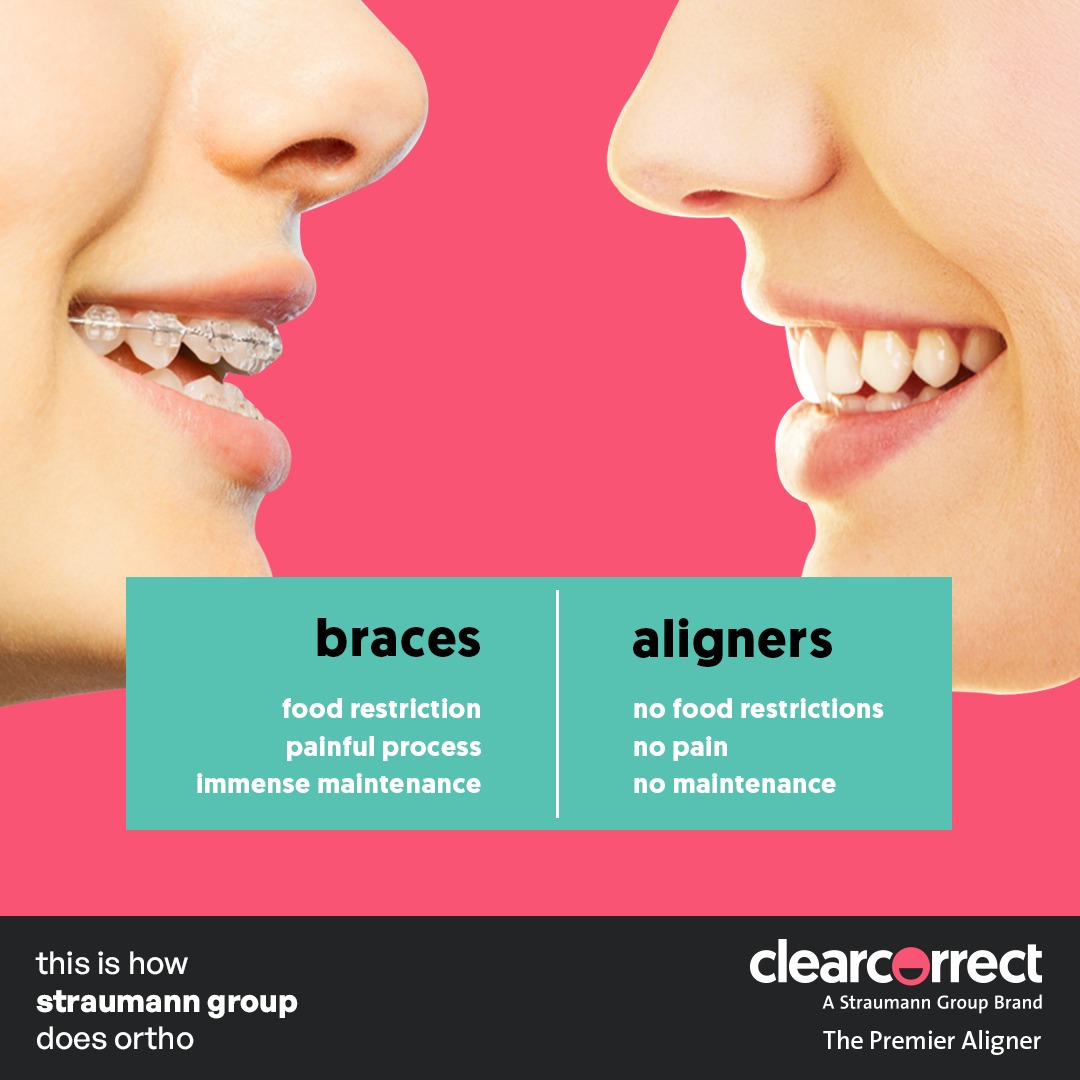ClearCorrectIN's tweet photo. Don't go through the pain and horrors of tooth alignment. Switch to clearcorrect aligners and experience sheer freedom.

#ClearCorrectIndia #ClearCorrectIn #StraumannGroup #Smile #Aligners #PainFree #StressFree #StainResistant https://t.co/MBG1zFvC2h