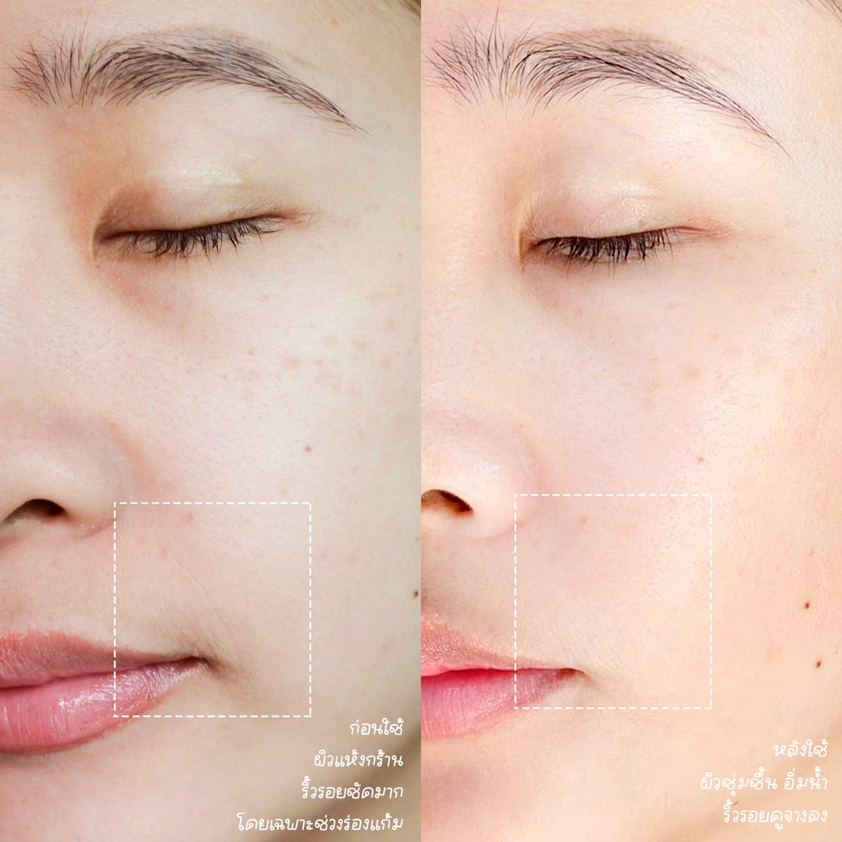 ZeibabReview's tweet photo. เลข 3 แล้วต้องใช้อะไรดูแลผิว! หน้าแห้งเกิดริ้วรอยง่าย เลยเลขสามยิ่งง่ายไปอีก ไปเจอตัว IT COSMETICS BYE BYE LINES SERUM เค้าช่วยให้ผิวเต่งตึง ลดริ้วรอย แถมยังช่วยให้ผิวชุ่มชื้นด้วย นี่ใช้แล้วรู้สึกเลยว่าผิวเปลี่ยนแปลงไปในทางที่ดีขึ้น แถมเนื้อเค้าเบาสบายผิวมากเด้อ #ITCosmeticsTH https://t.co/gNIwTupDIz