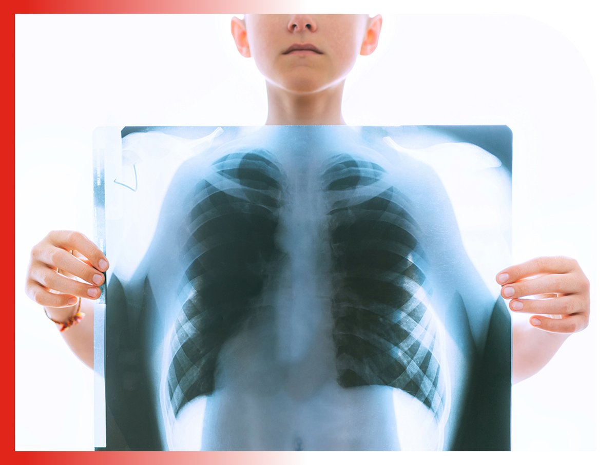 Pediatric pulmonologists diagnose, treat, and manage children from birth to 21 years old with breathing and lung diseases.
@Jessicafourm 
 #cardiologists #secretionclearance #medical #medstudent #lungshealth #pediatrician #pneumonia #fever #medschool #telemedicine #allergy