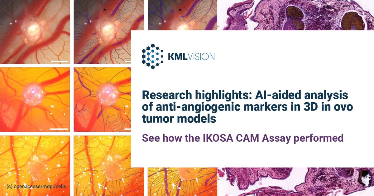 WeAreKolaido's tweet photo. Research uses of the IKOSA CAM Assay App for evaluating the anti-angiogenic effects of gluconate in a 3D in ovo tumor model. https://t.co/fkHmtjGvYR #KMLVision #IKOSA #digitalpathology #angiogenesis #camassay #CAMassay #mdpi #UniRegensburg #DeggendorfInstituteofTechnology https://t.co/5IB6xPRgO8