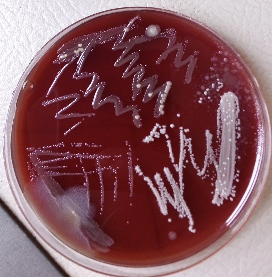 How #Microbiology is amazing! My students working on different bacteria! After getting pure cultures, next is… Antibiogram