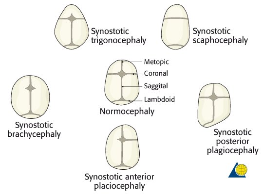 yangisabelle1's tweet photo. why do providers love to write “Exam: HEENT-normocephalic” in their notes https://t.co/Hn1BLfpRzs