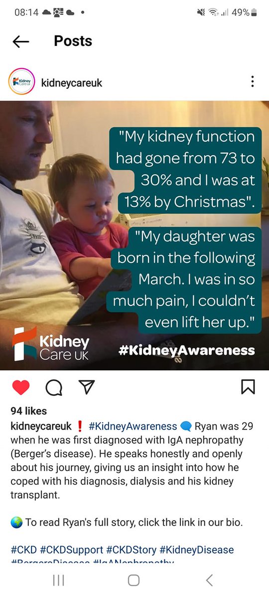 My face is very swollen here, right in the depths of steroids and dialysis. 
<a href="/kidneycareuk/">Kidney Care UK @kidneycareuk.bsky.social</a> have published a story about the gooseneck blessed troubles I had. 
.
kidneycareuk.org/.../your-stori… 
.
#kidneystrong #kidneyfailure #iga #iganephropathy #kidney