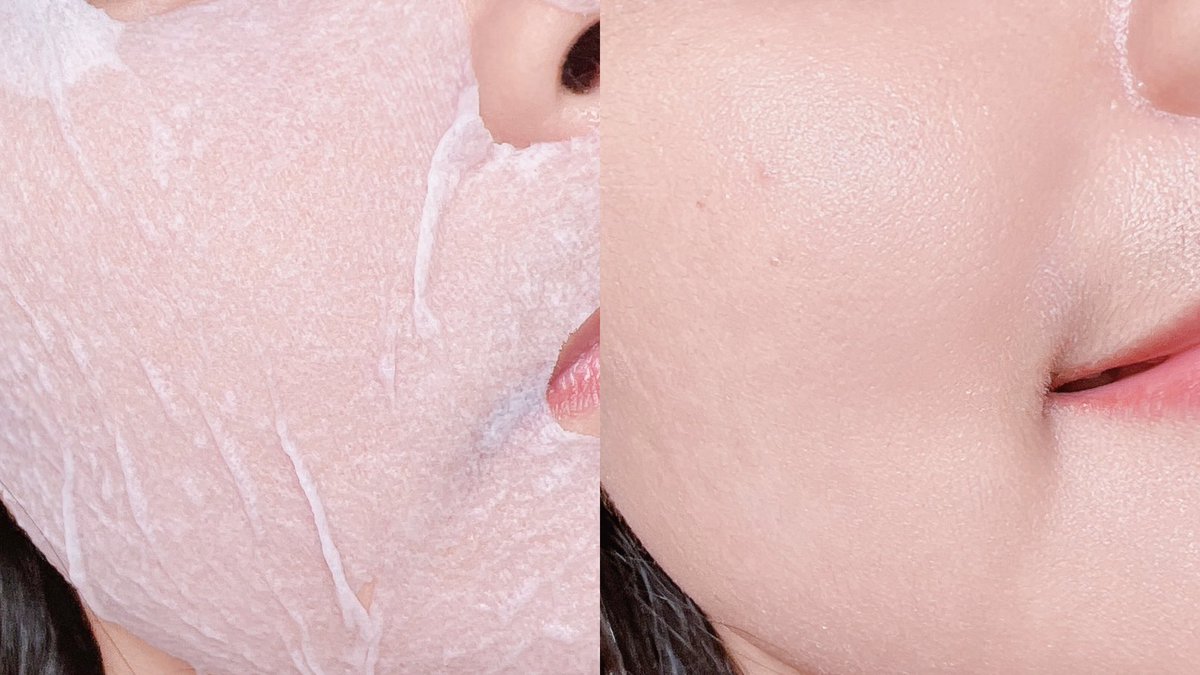 โทนเนอร์ลูกรักคนเป็นสิว🩹🥣 #โทนเนอร์พี่จุน Anua Heartleaf 77% 🌿 ช่วงไหนผิวโทรม สิวผดมาเต็ม นี่ชอบใช้โทนเนอร์+เม็ดมาสก์ มาสก์หน้าทิ้งไว้ ช่วยปรับสมดุลผิว ลดการอักเสบได้ดีมากกก สิวหายไวขึ้นเยอะ คนมีสิวควรมีติดสักขวดจริง #ใช้ดีบอกต่อ